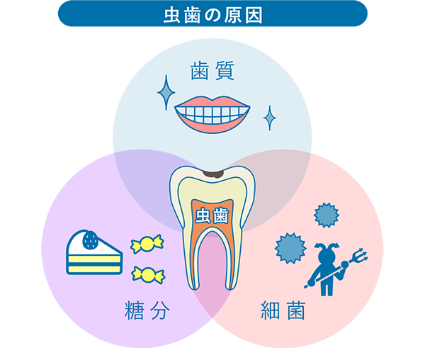 虫歯とは